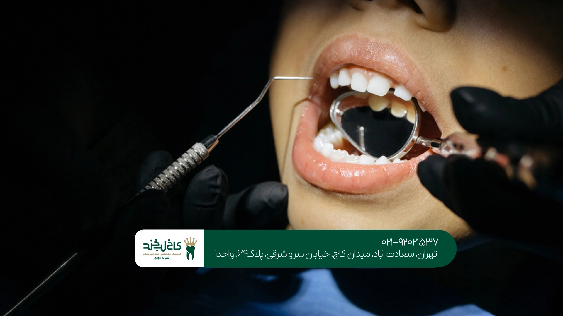 خدمات بهترین دندانپزشکیهای تهران