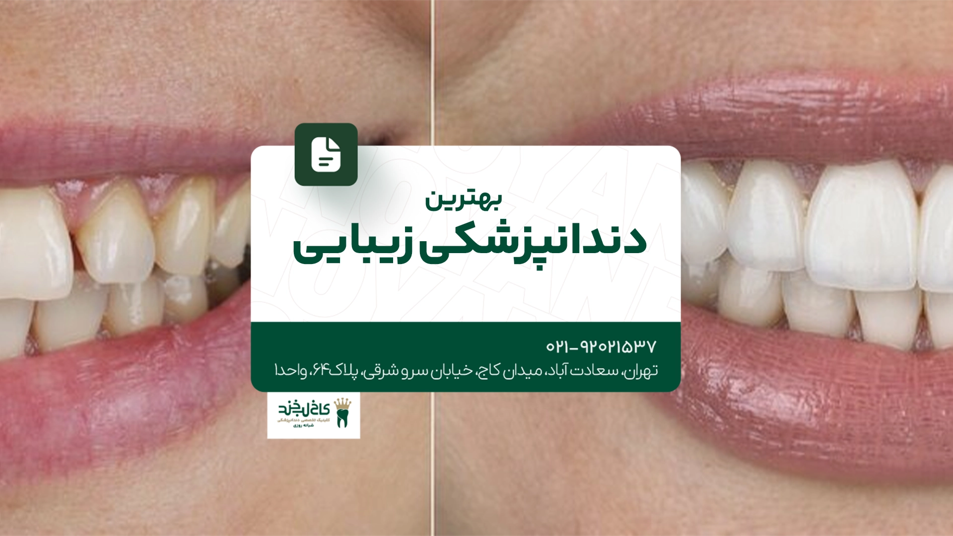 بهترین دندانپزشکی زیبایی بهترین دندانپزشکی زیبایی