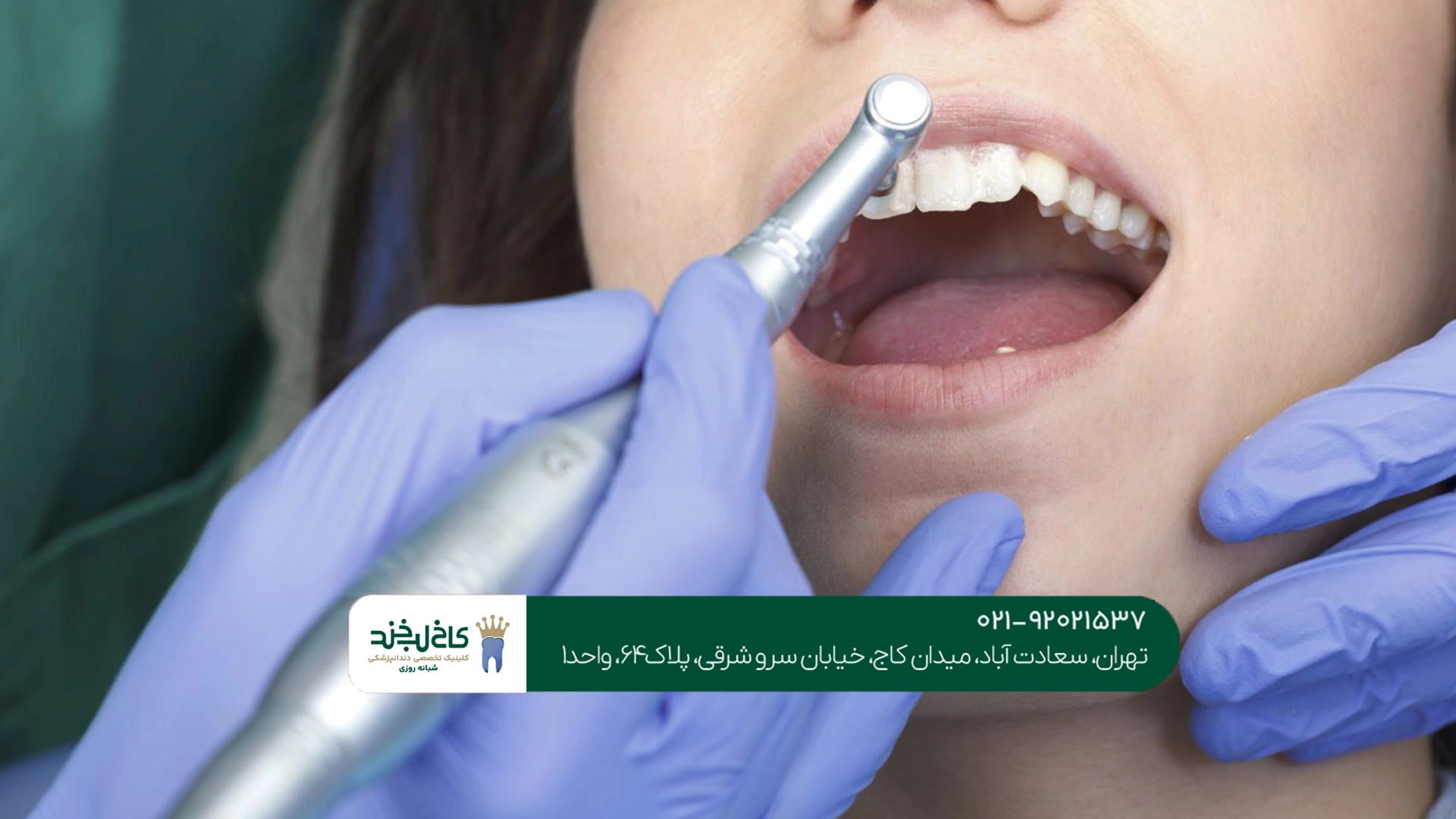 بهترین دندانپزشکی زیبایی بهترین دندانپزشکی زیبایی