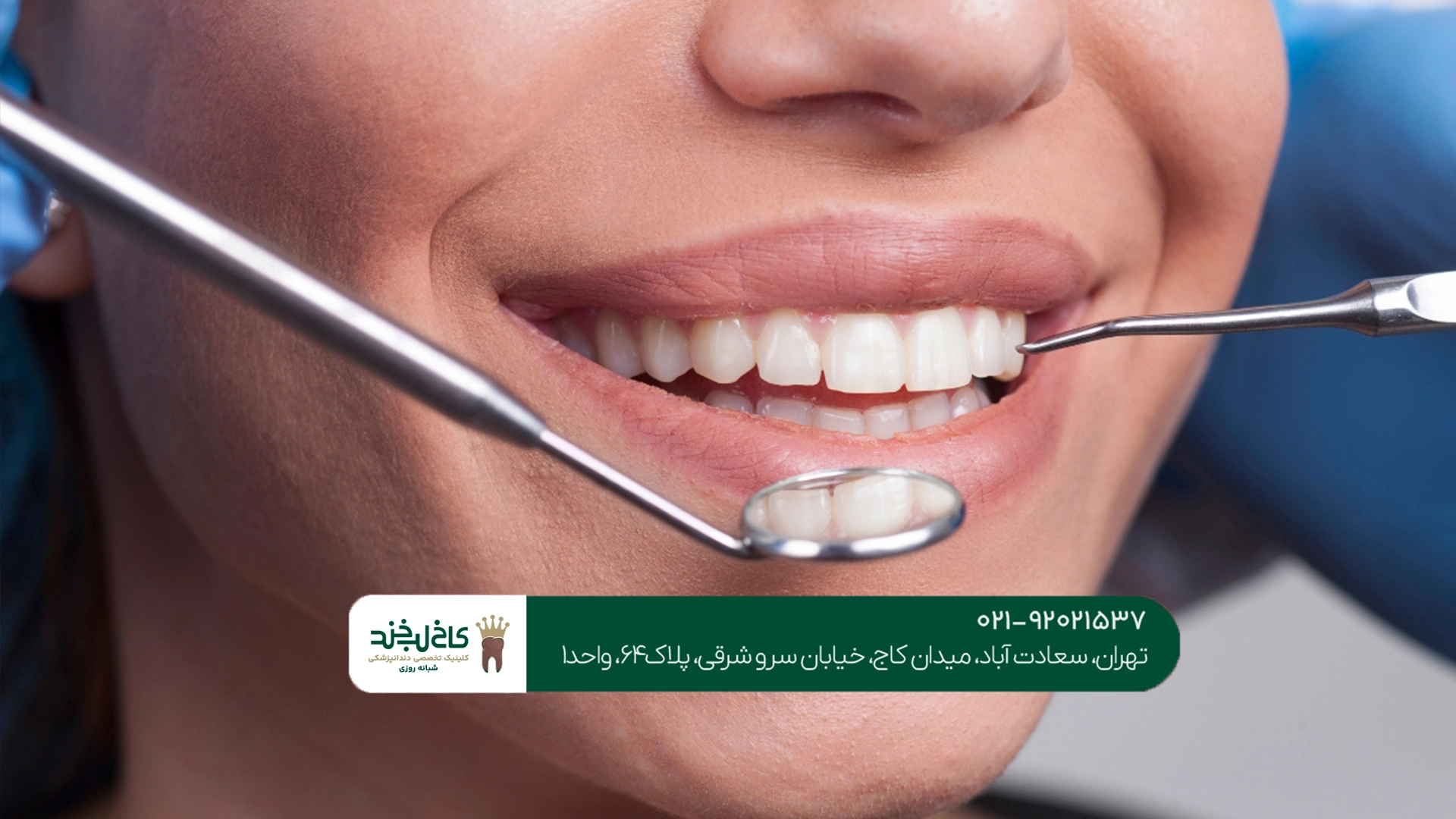 دندانپزشکی زیبایی دندانپزشکی زیبایی