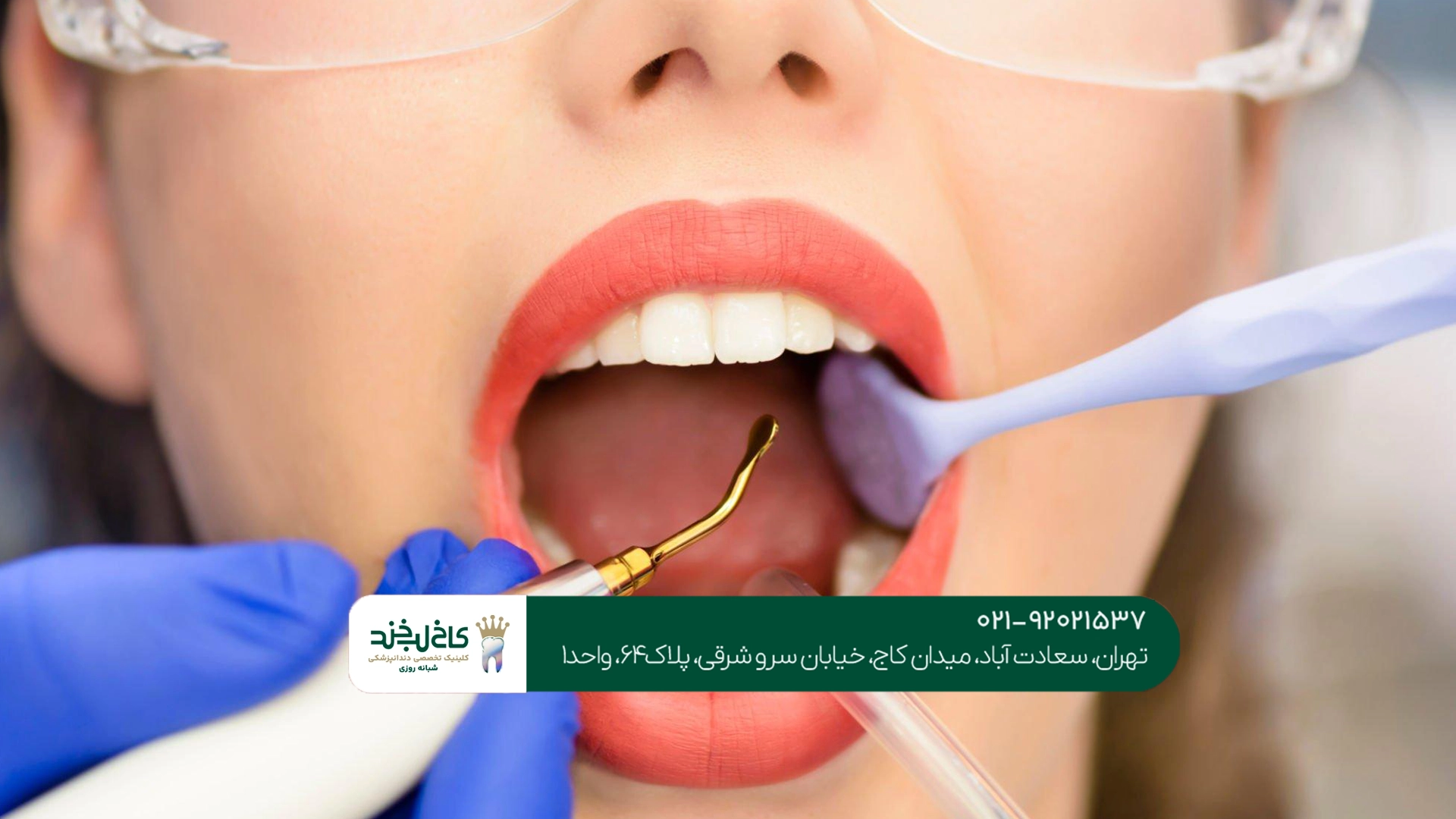 دندانپزشکی زیبایی تهران