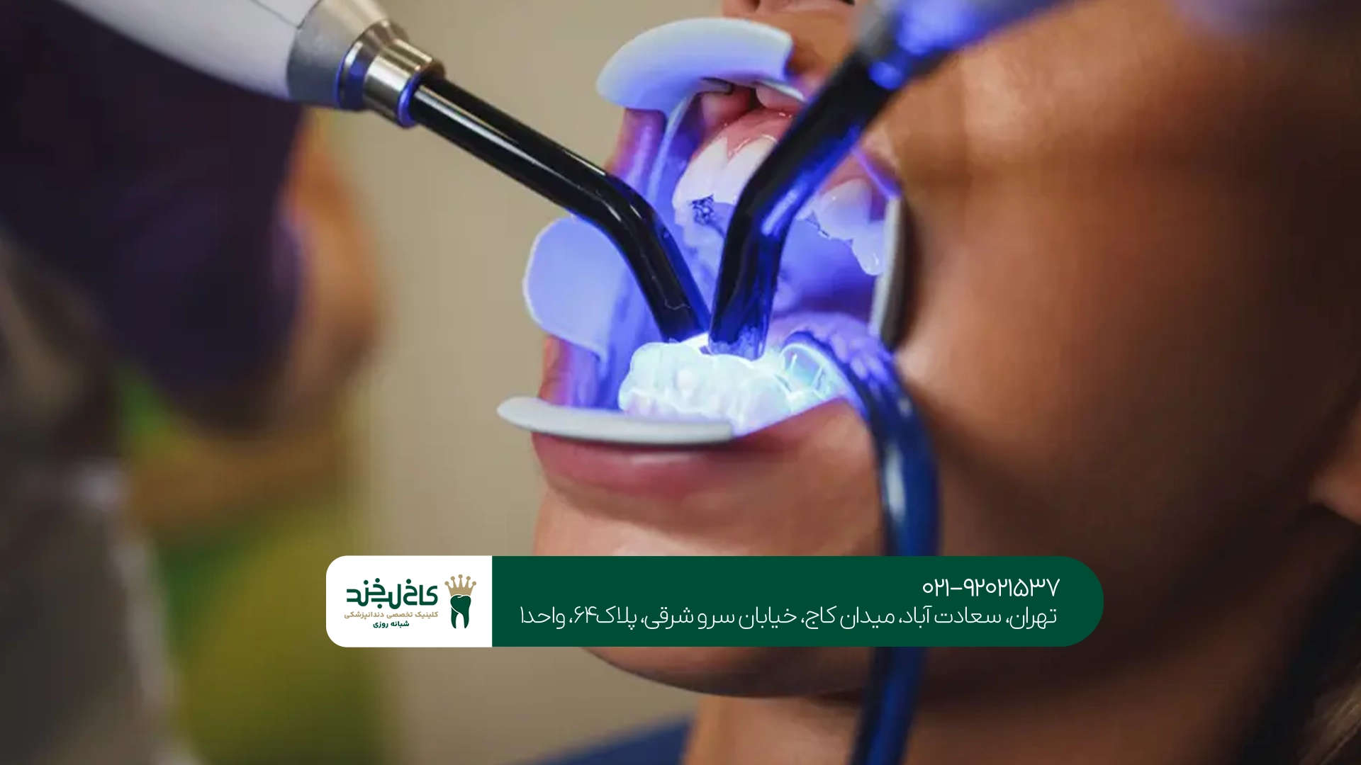 بهترین کلینیک کامپوزیت سعادتآباد