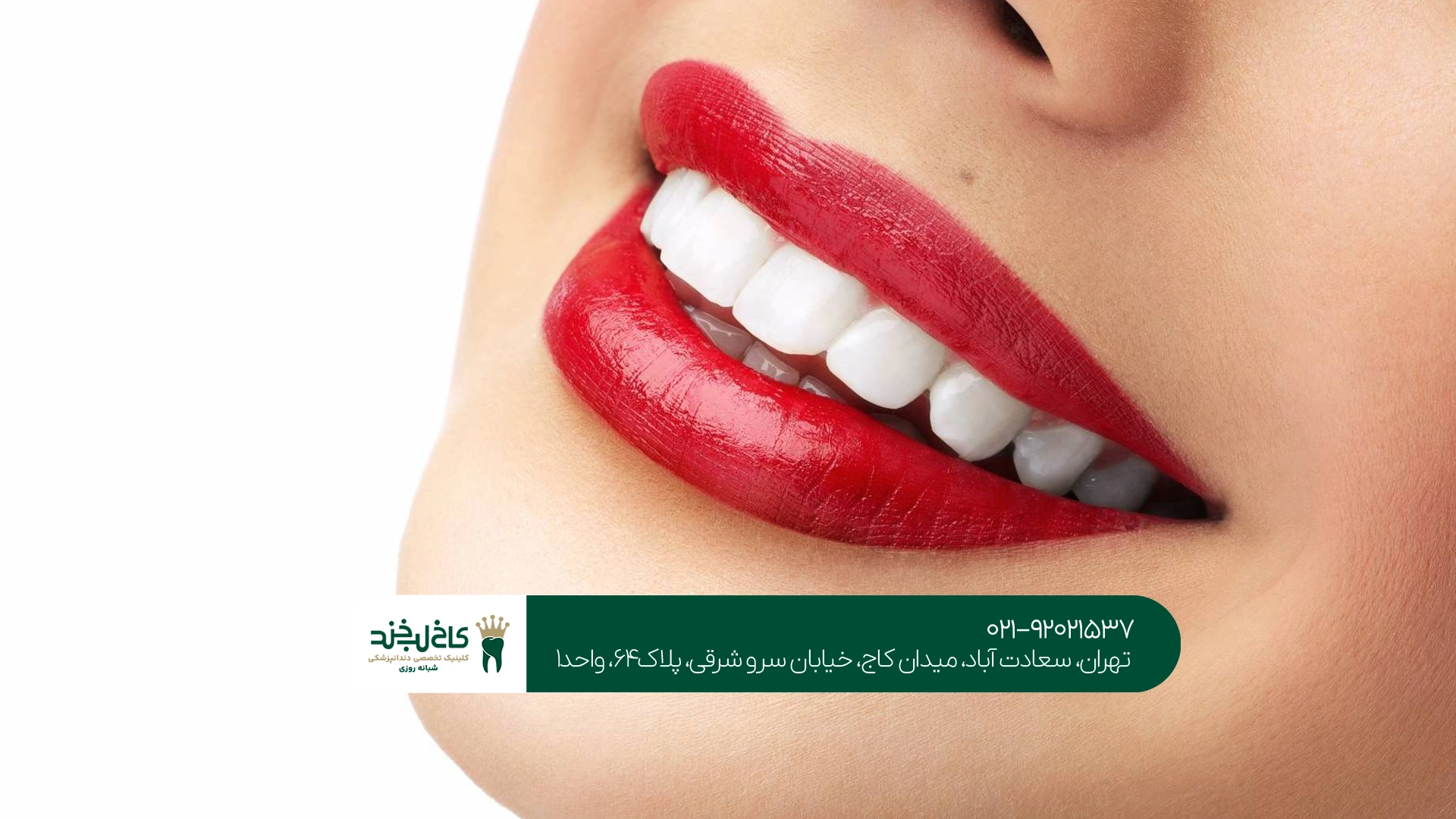 تفاوت کار دندانپزشک عمومی و متخصص در کامپوزیت دندان