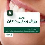 بهترین روش زیبایی دندان