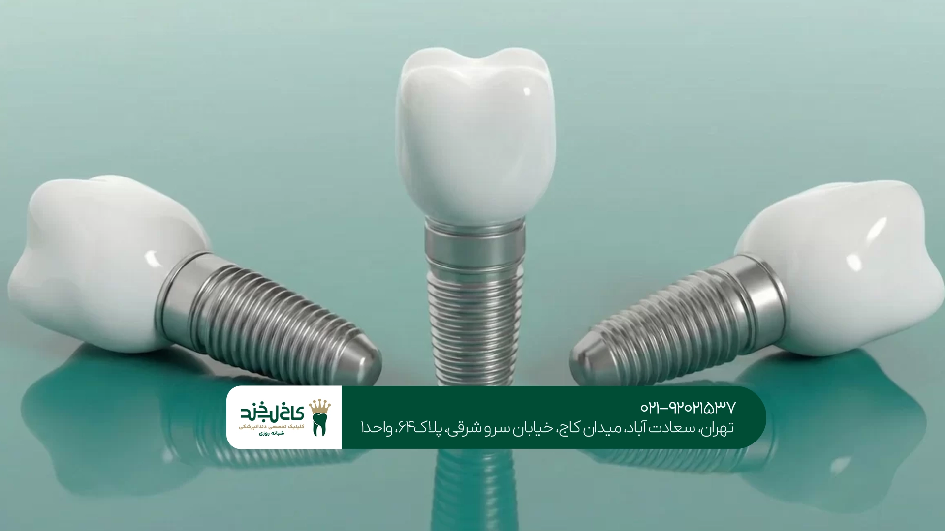 بهترین برند ایمپلنت بهترین برند ایمپلنت