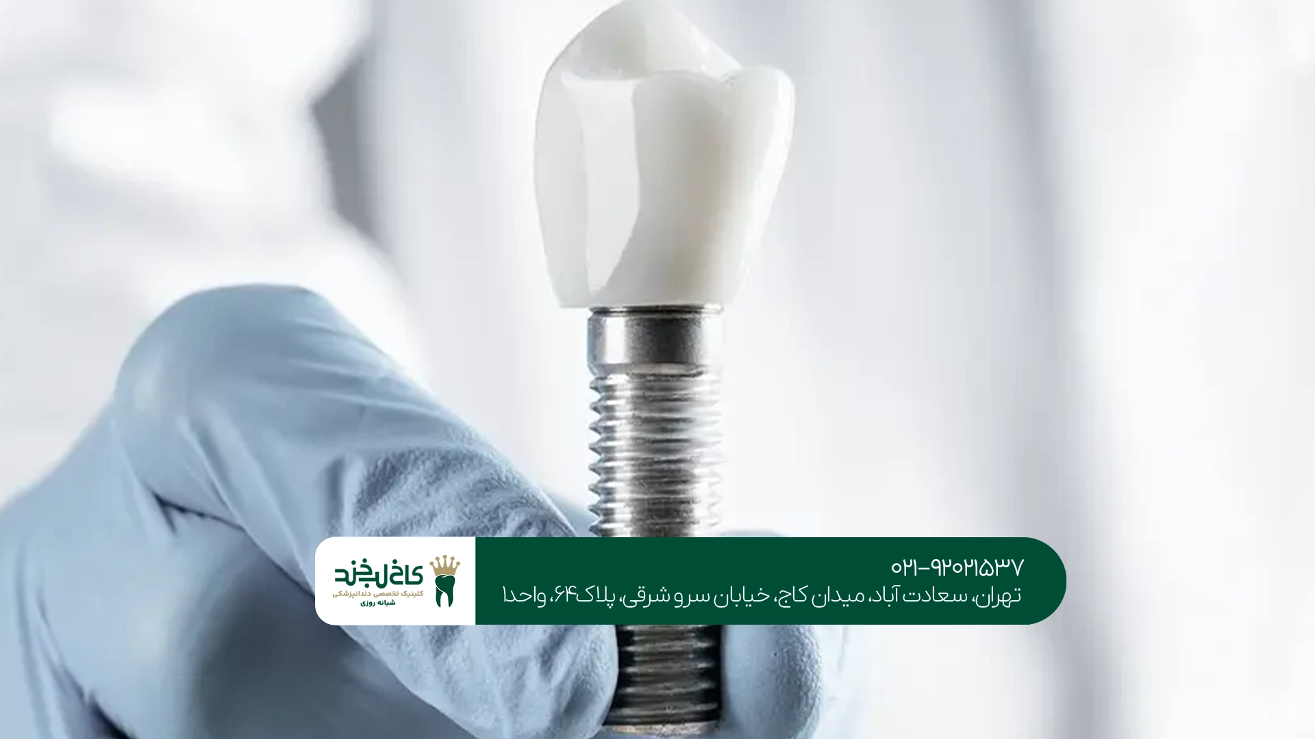 بهترین ایمپلنت دندان برای کاشت فوری بهترین ایمپلنت دندان برای کاشت فوری