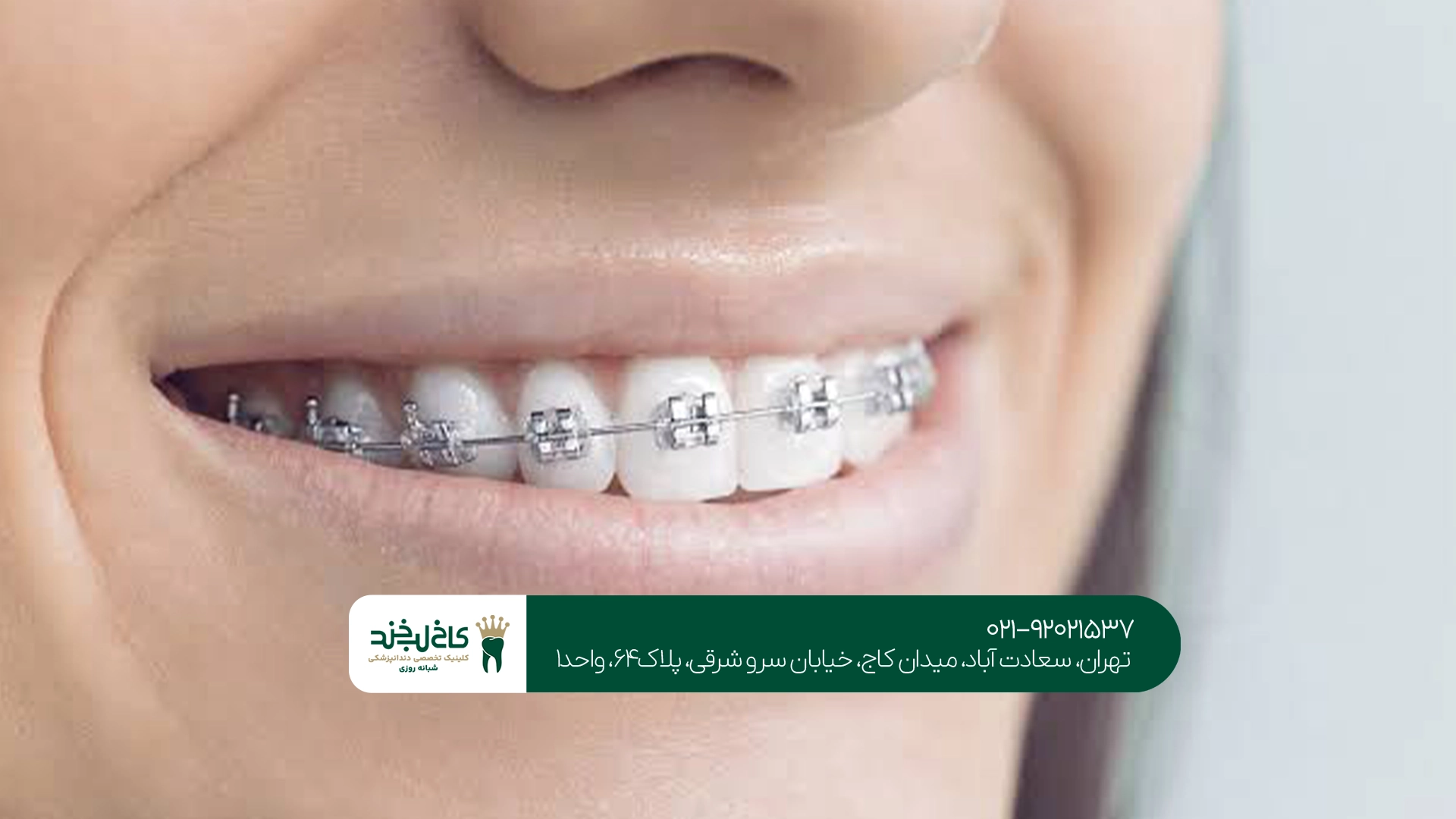 بهترین مرکز ارتودنسی برای کودکان و بزرگسالان