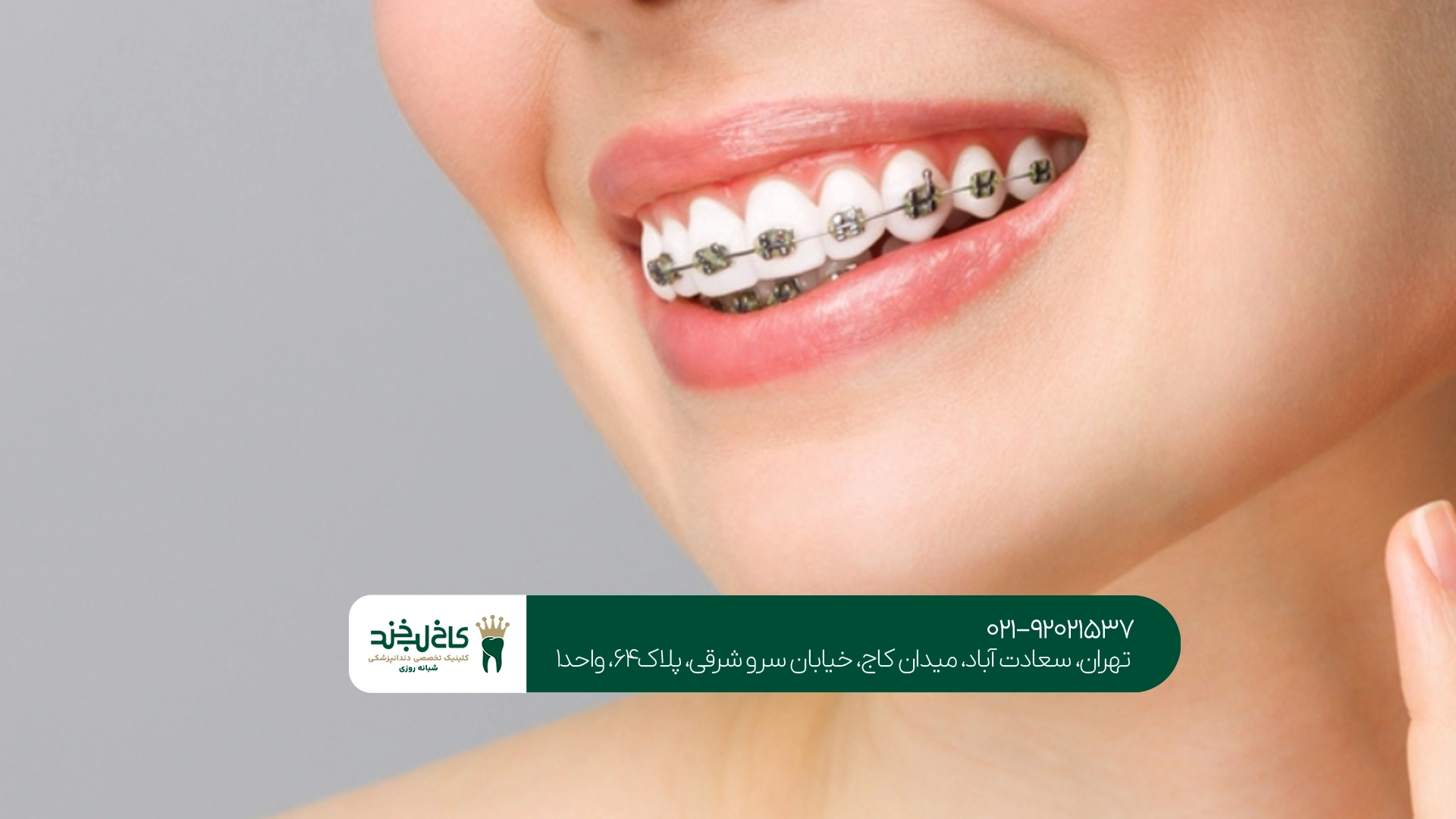 متخصص ارتودنسی برای ارتودنسی نامرئی