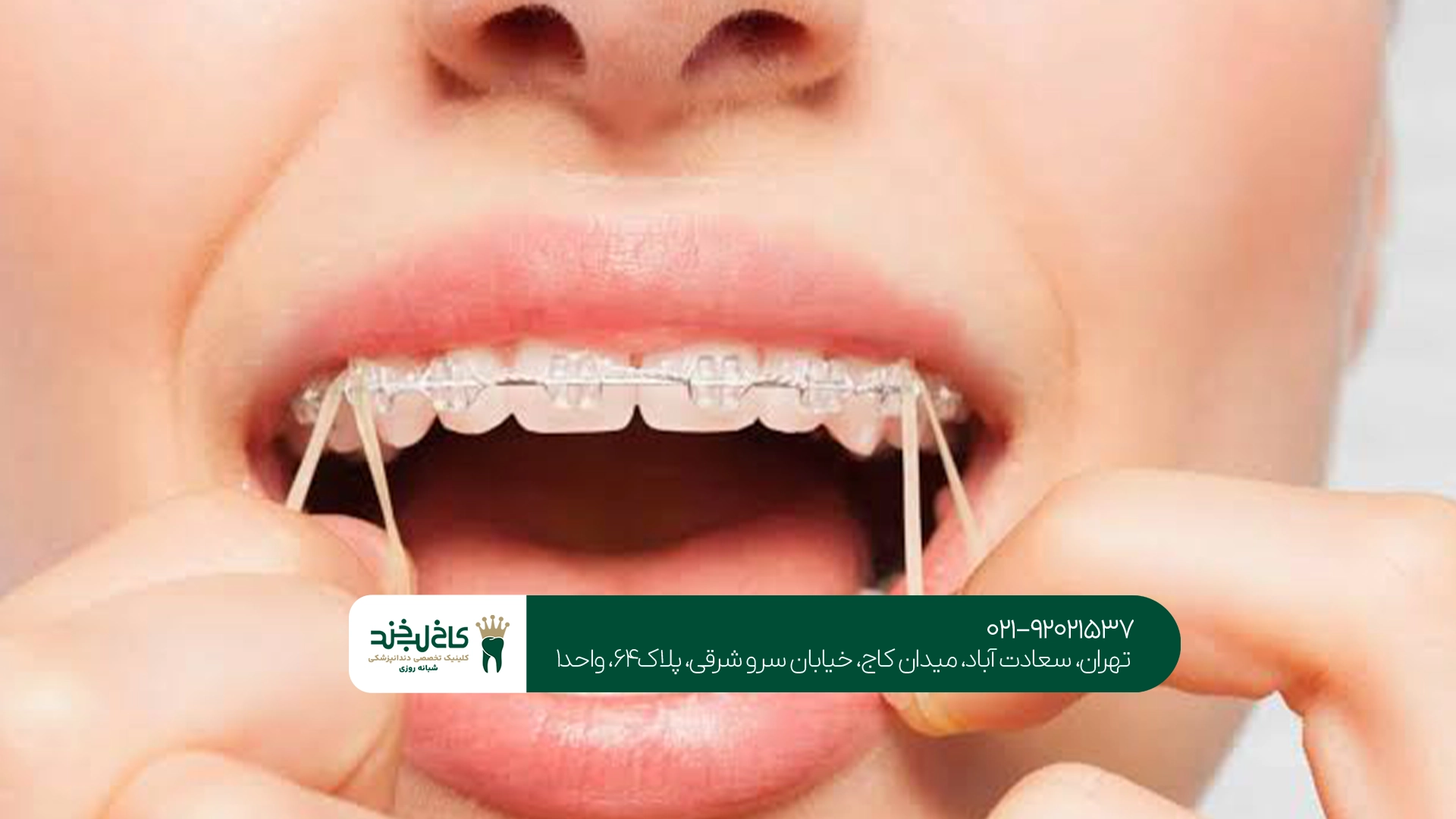 بهترین متخصص ارتودنسی دندان