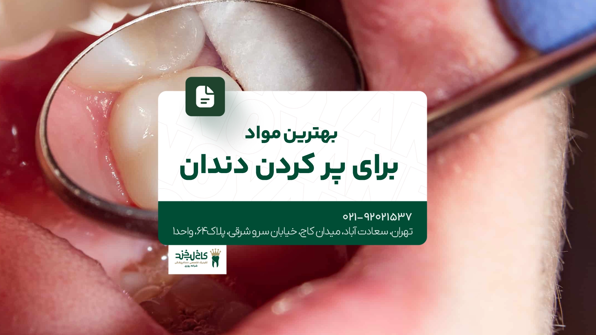 بهترین مواد برای پر کردن دندان