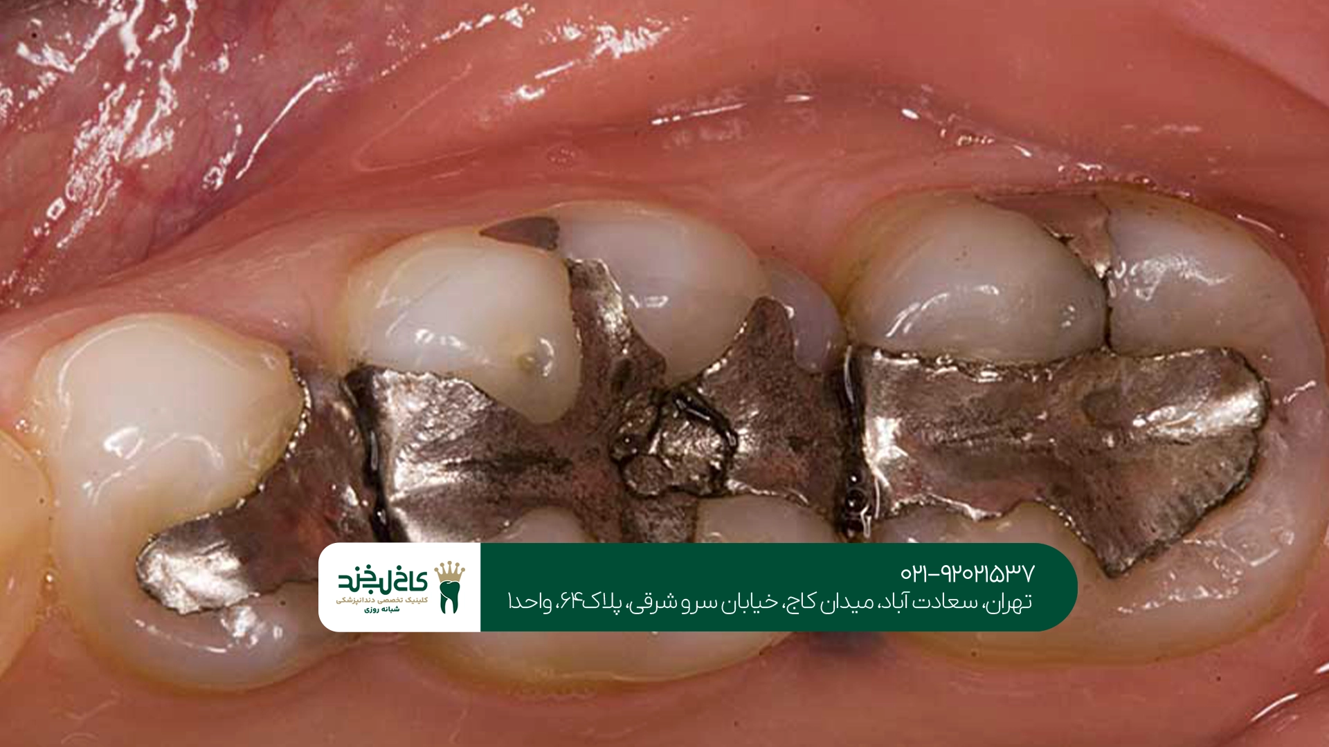 دندانپزشکی ترمیمی و زیبایی