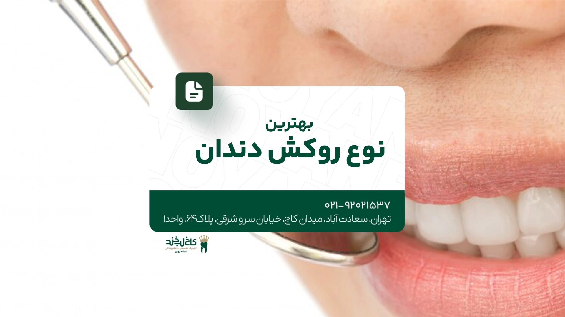 بهترین نوع روکش دندان