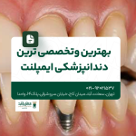 بهترین و تخصصی ترین دندانپزشکی ایمپلنت