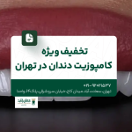 تخفیف ویژه کامپوزیت دندان در تهران