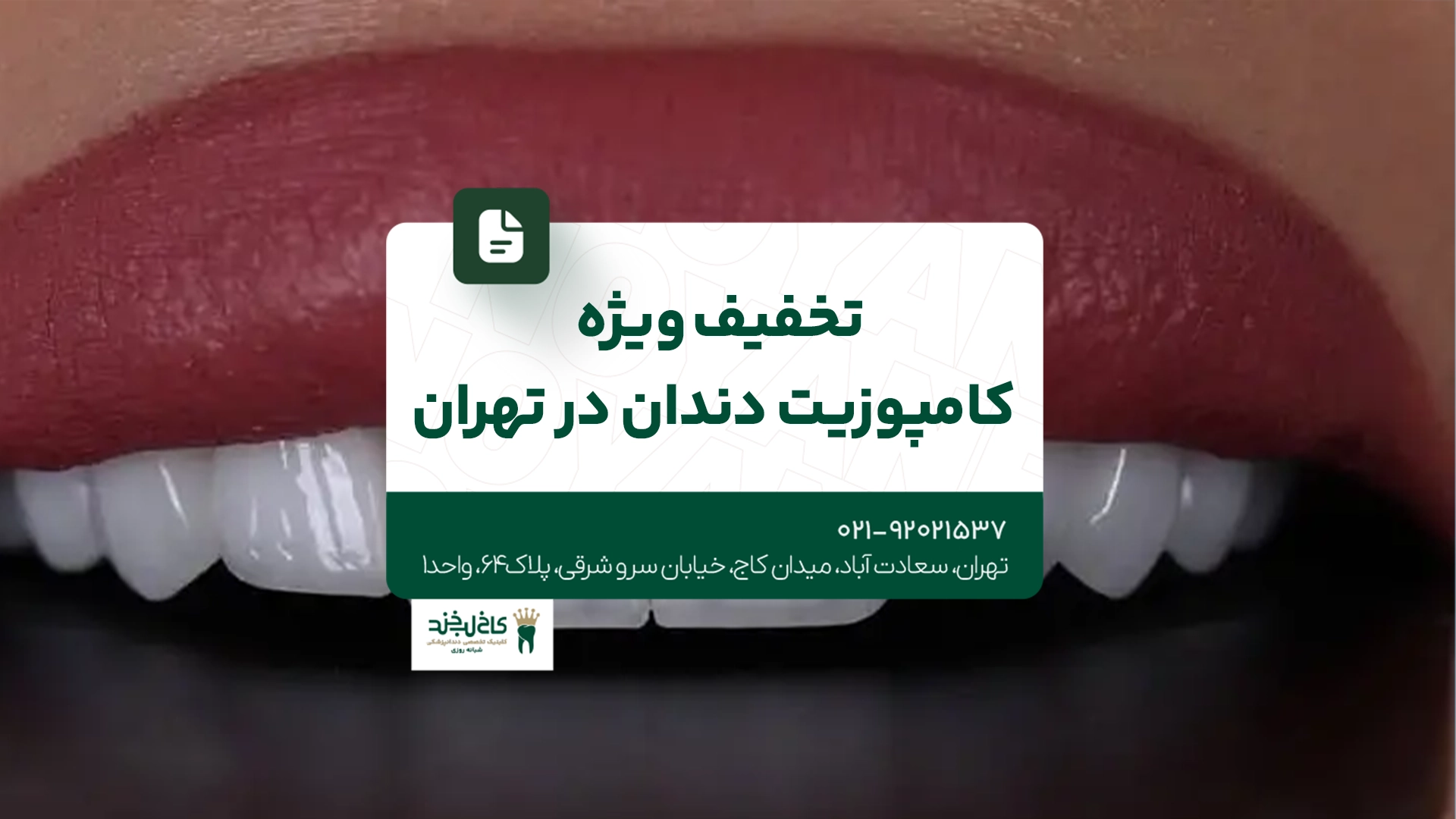 تخفیف ویژه کامپوزیت دندان در تهران تخفیف ویژه کامپوزیت دندان در تهران