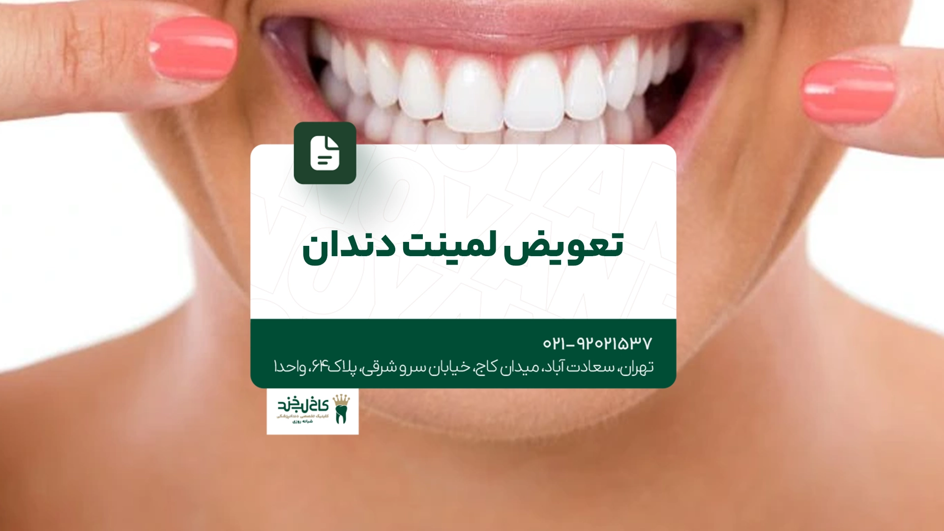تعویض لمینت دندان