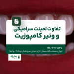 تفاوت لمینت سرامیکی و ونیر کامپوزیت