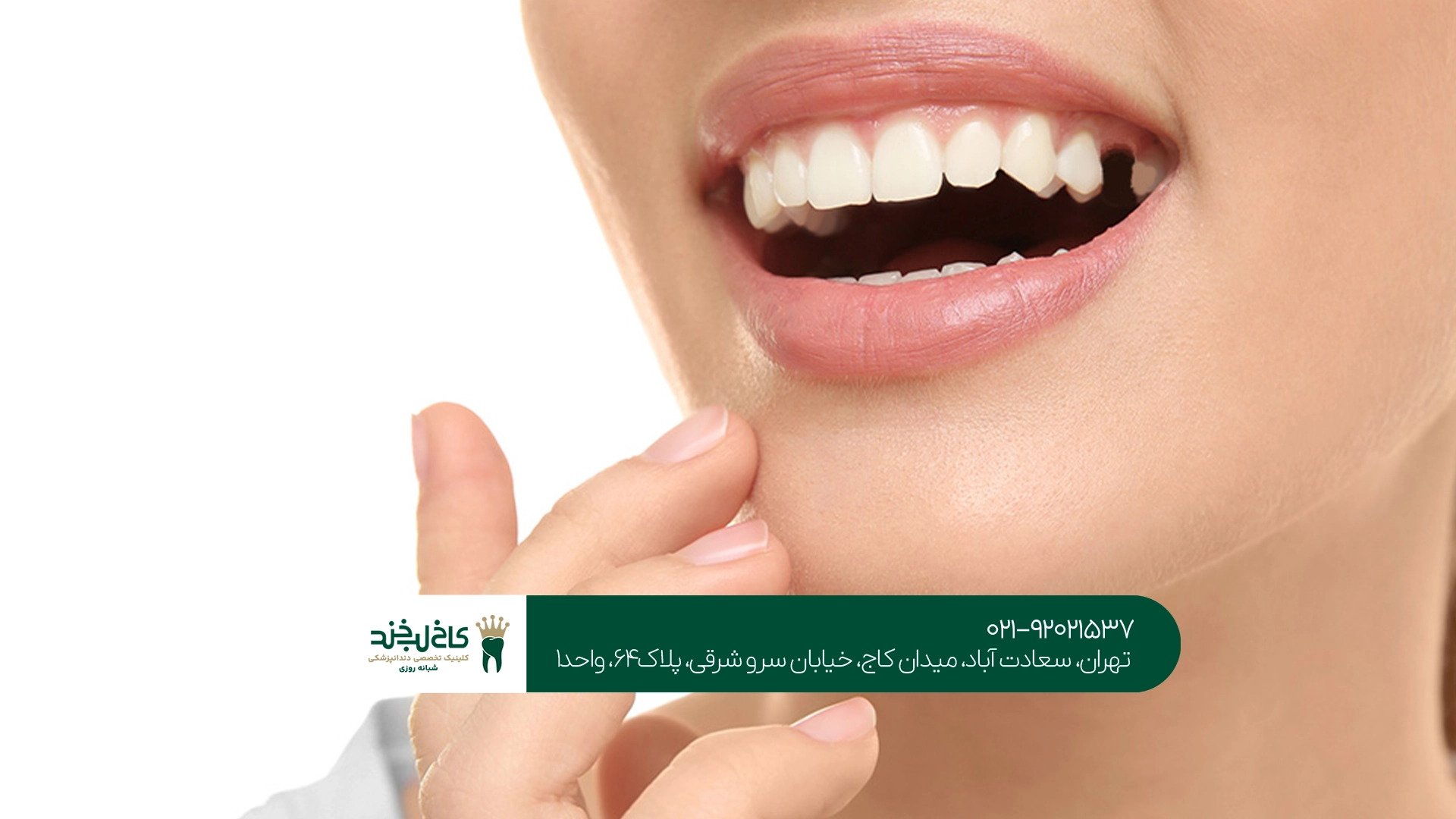بریج دندان برای چه افرادی مناسب است؟
