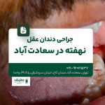 جراحی دندان عقل نهفته در سعادت آباد