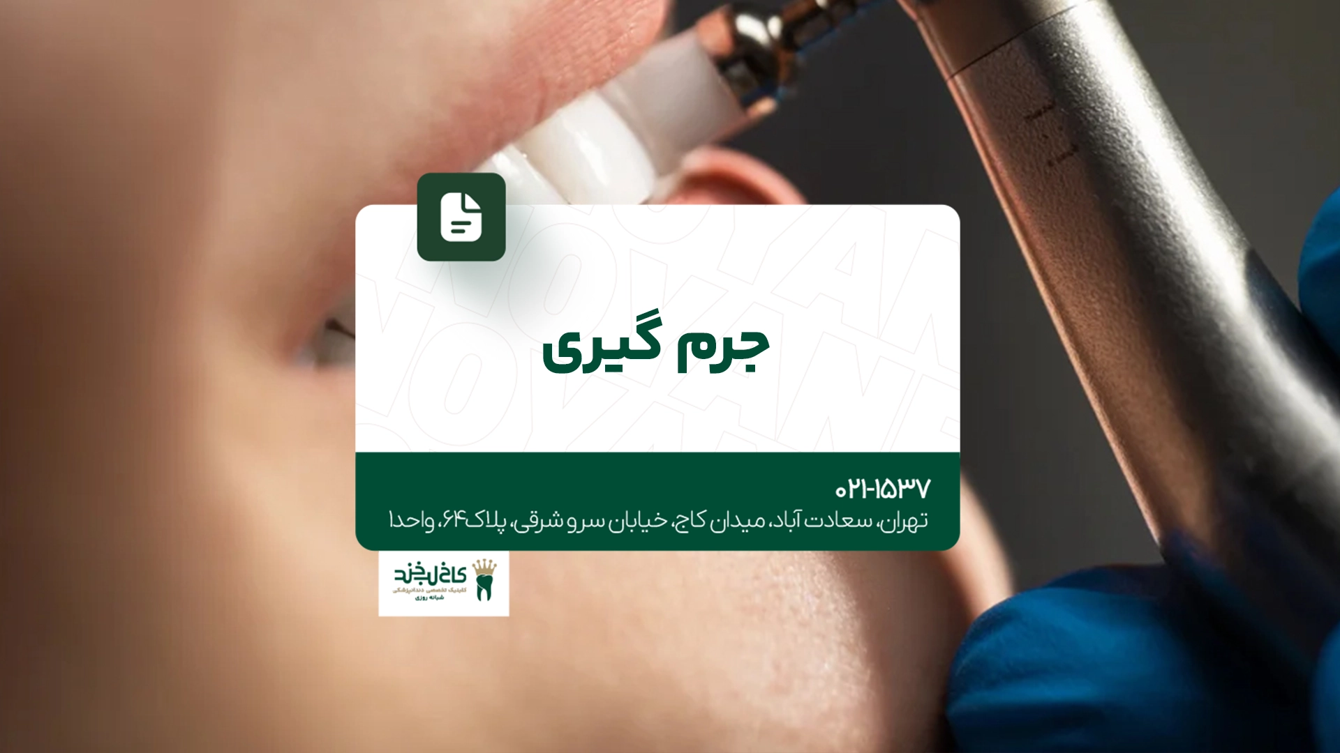 جرم گیری