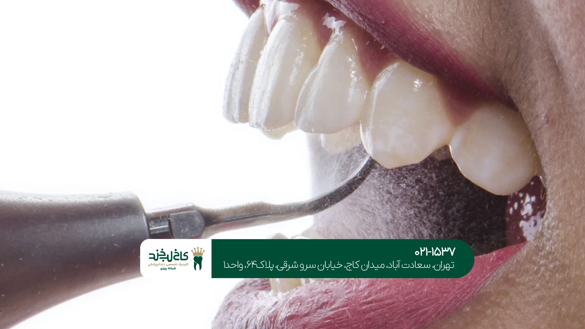 جرم گیری