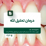 درمان تحلیل لثه