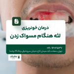 درمان خونریزی لثه هنگام مسواک زدن