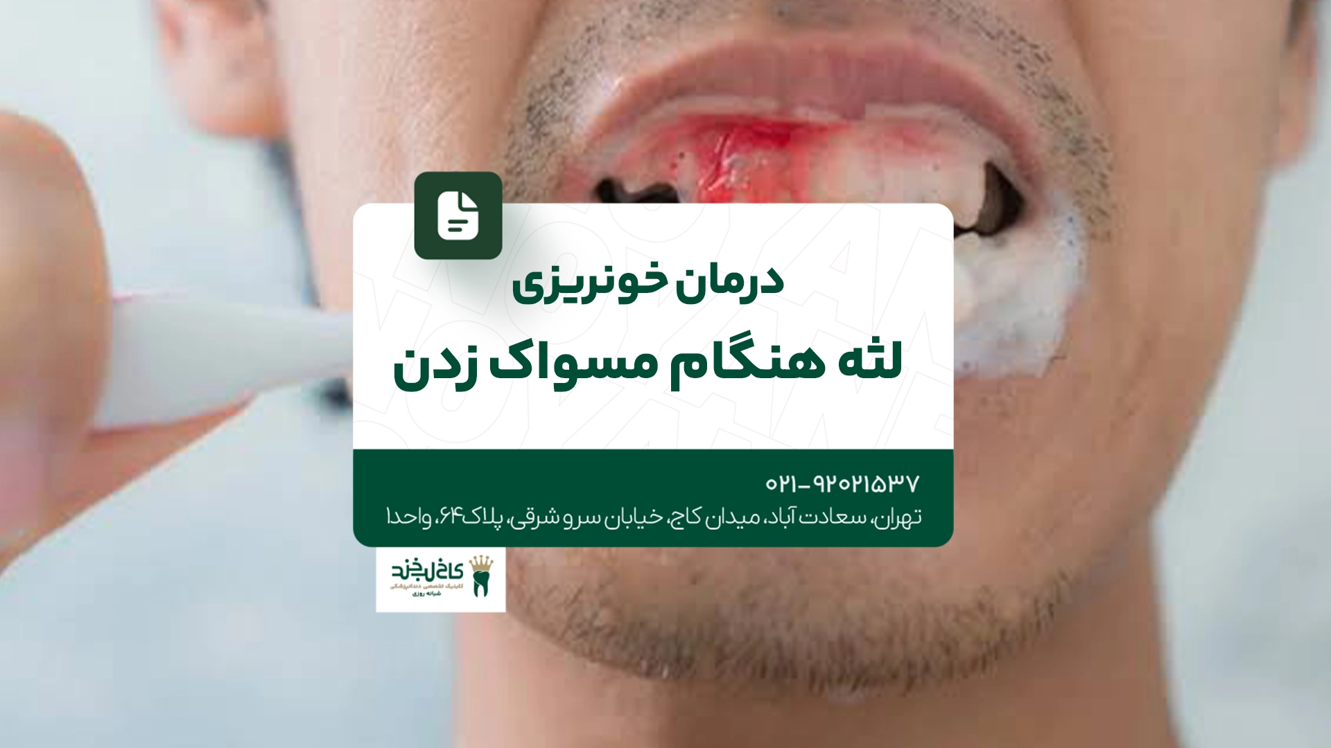 درمان خونریزی لثه هنگام مسواک زدن