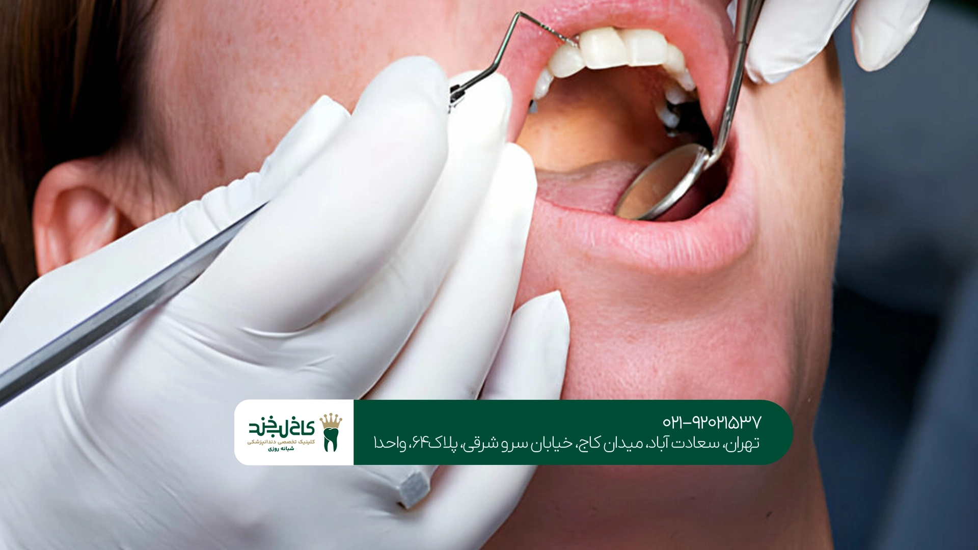درمان دندان با بی حسی دیجیتال