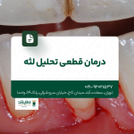 درمان قطعی تحلیل لثه