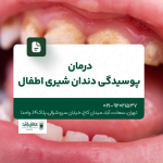 درمان پوسیدگی دندان شیری اطفال