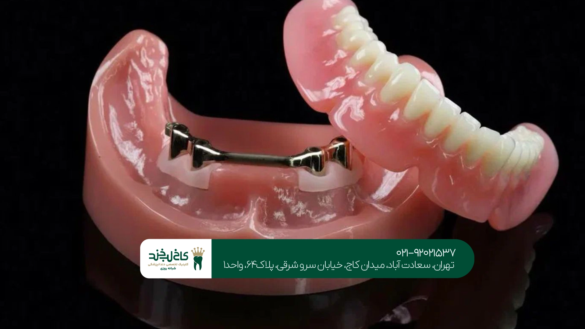دندان مصنوعی