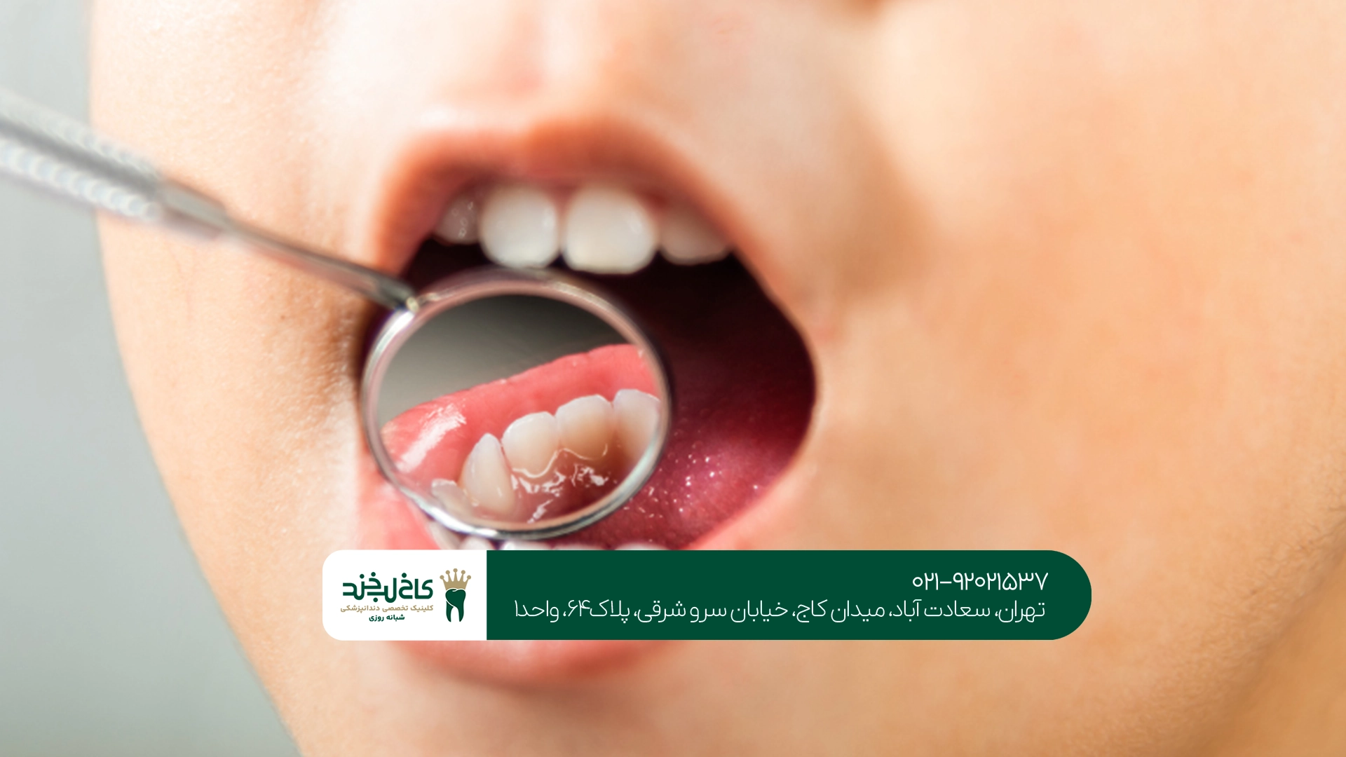 درمانهای رایج دندانپزشکی کودکان چگونه انجام میشود؟