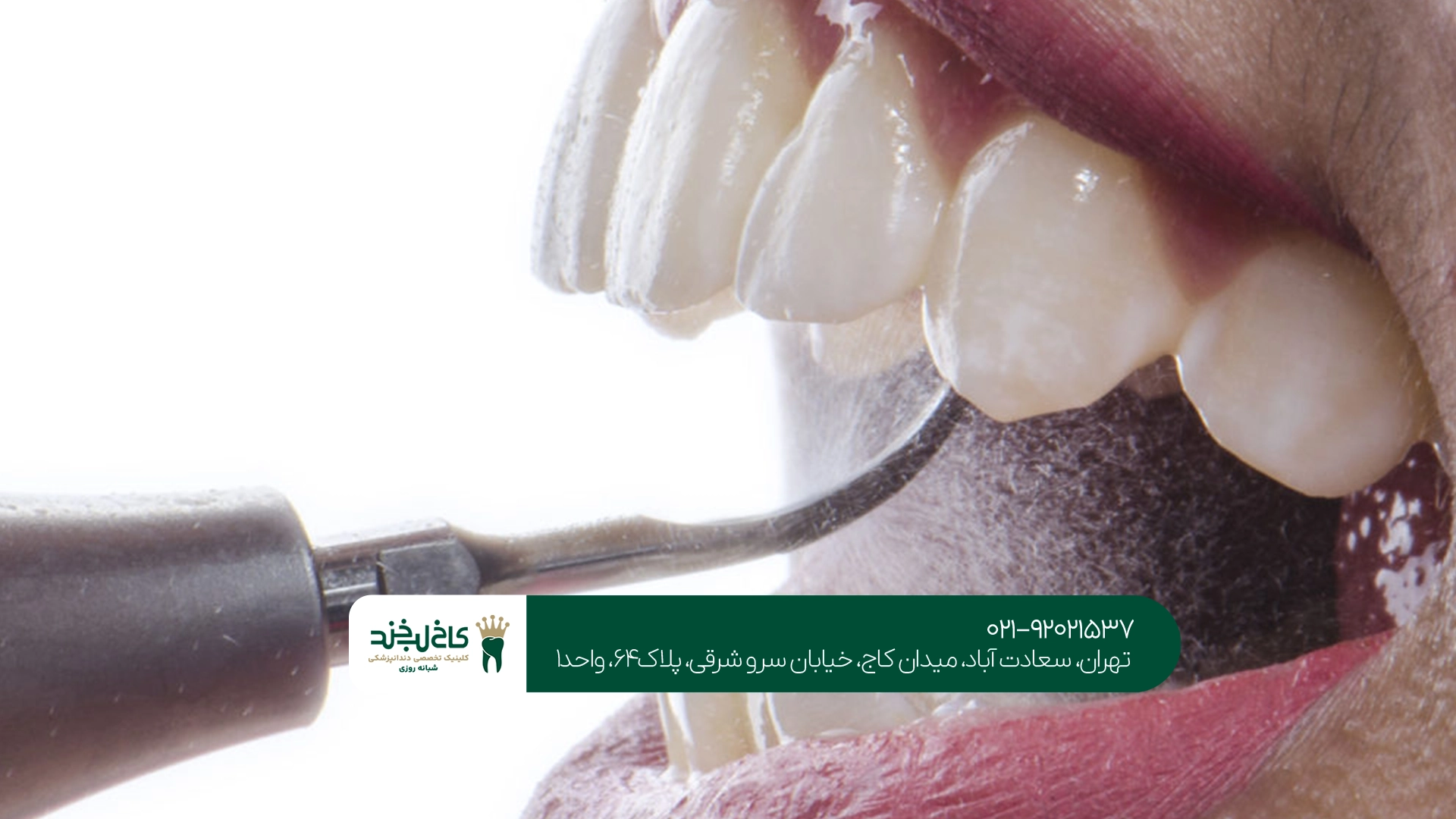 هزینه دندانپزشکی اقساطی