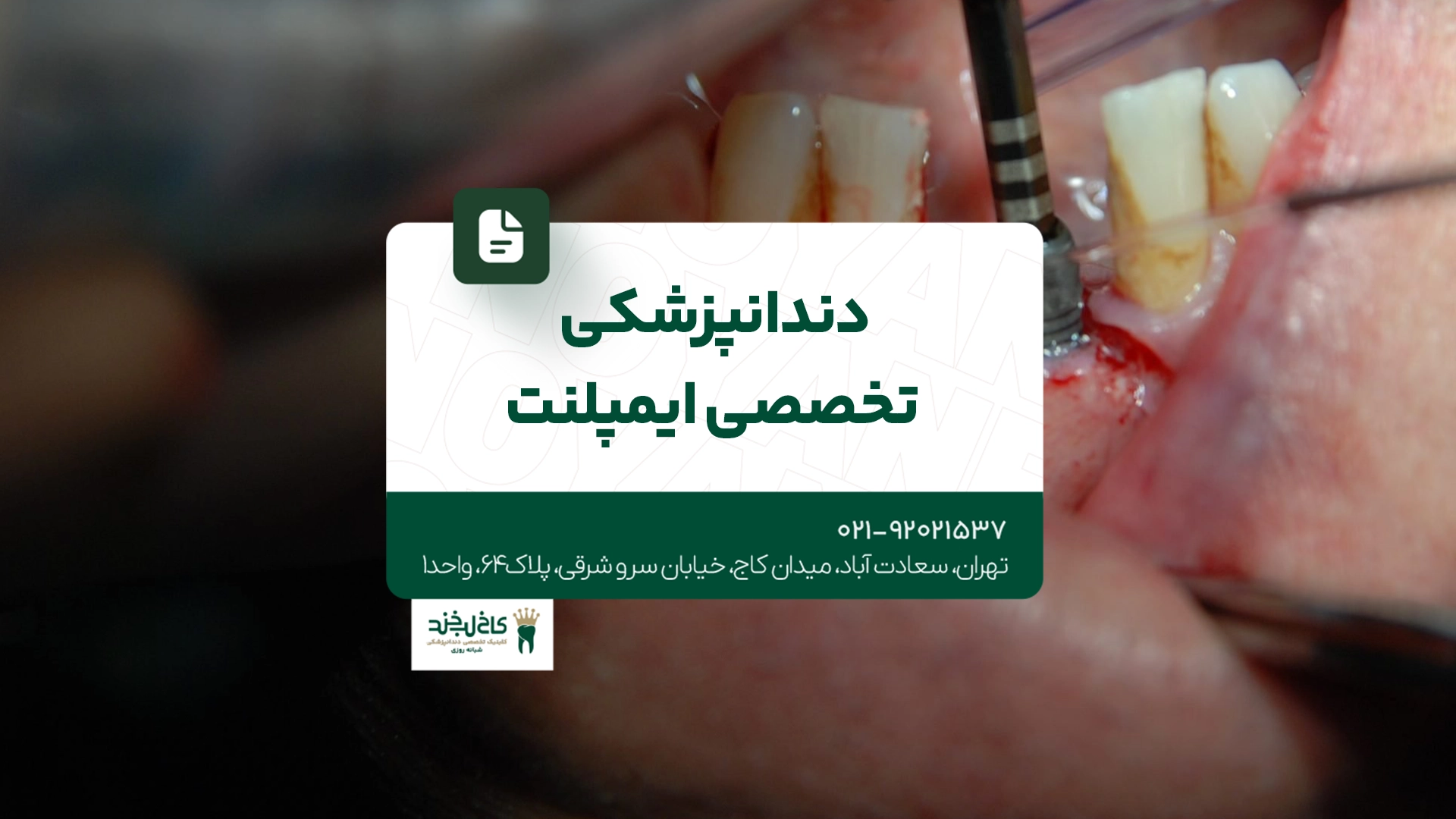 دندانپزشکی تخصصی ایمپلنت