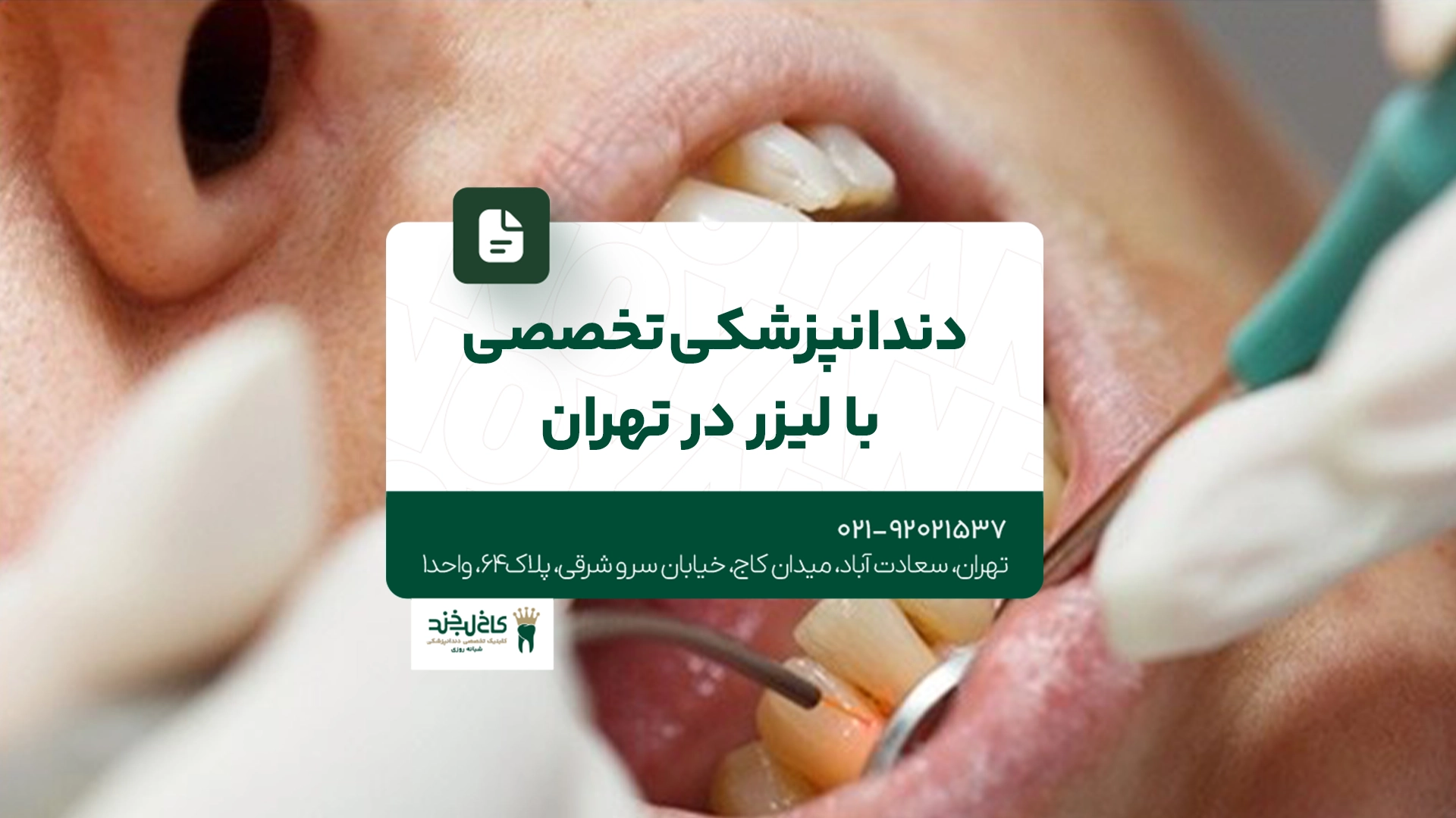 دندانپزشکی تخصصی با لیزر در تهران