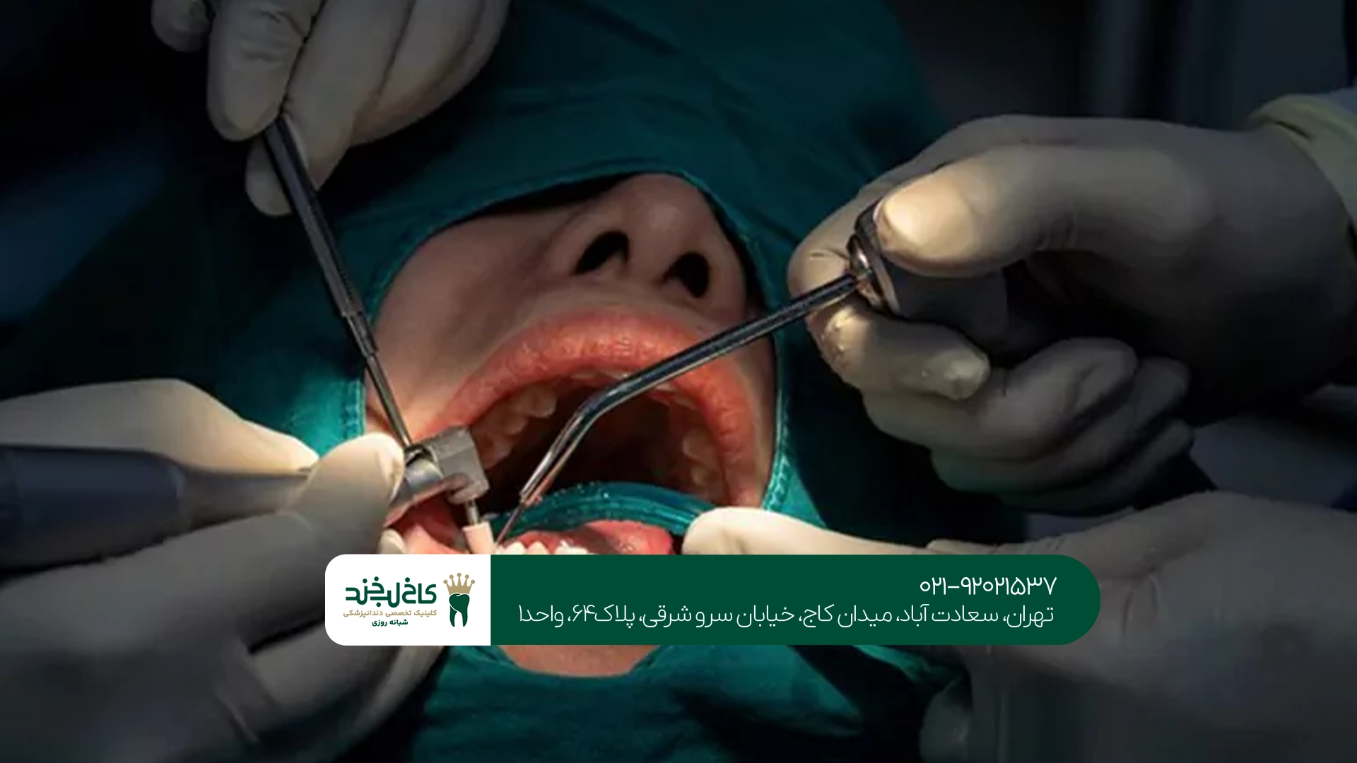 انواع جراحیهای دندانپزشکی در تهران