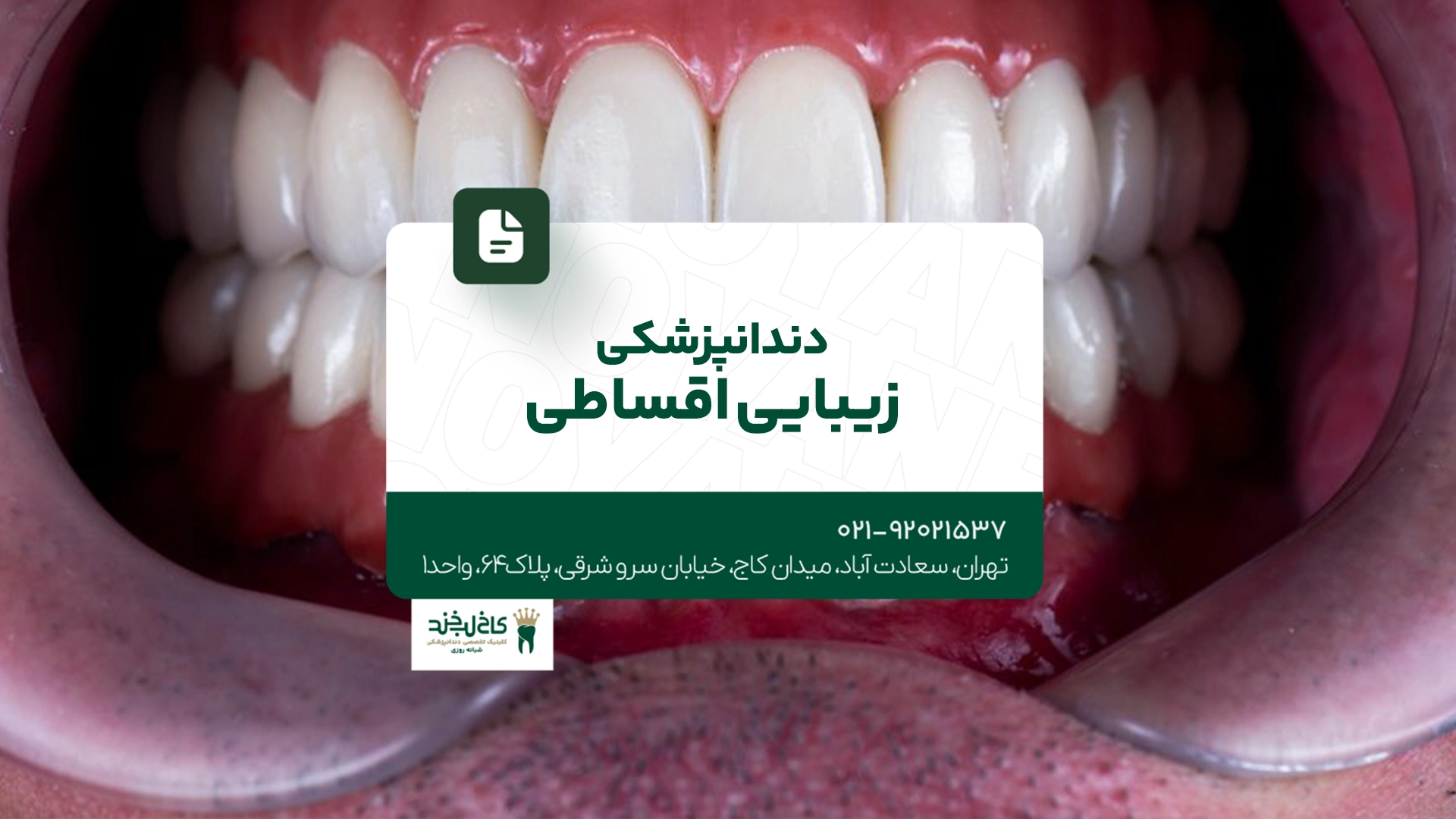 دندانپزشکی زیبایی اقساطی