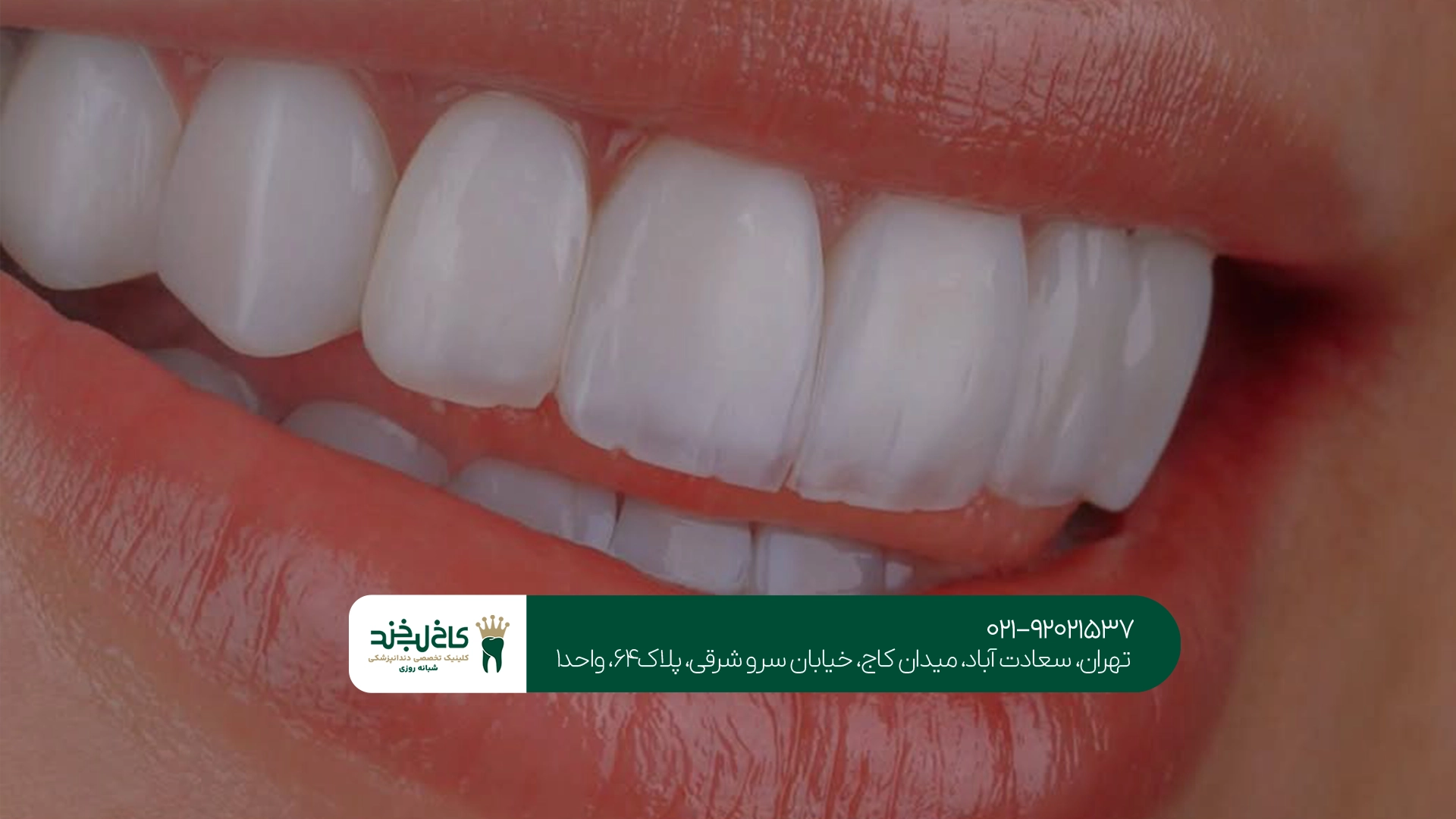 بهترین دندانپزشکی زیبایی اقساطی