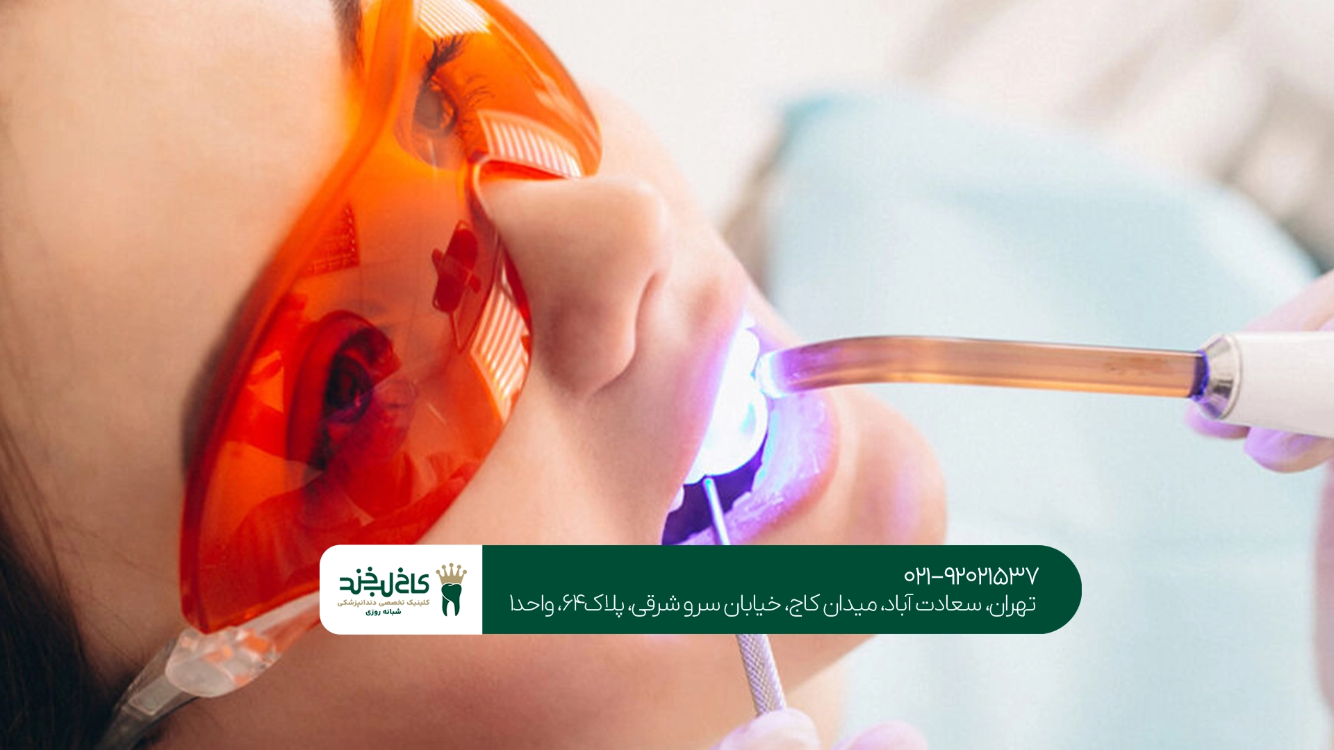 مزایای پرداخت اقساطی هزینههای دندانپزشکی زیبایی