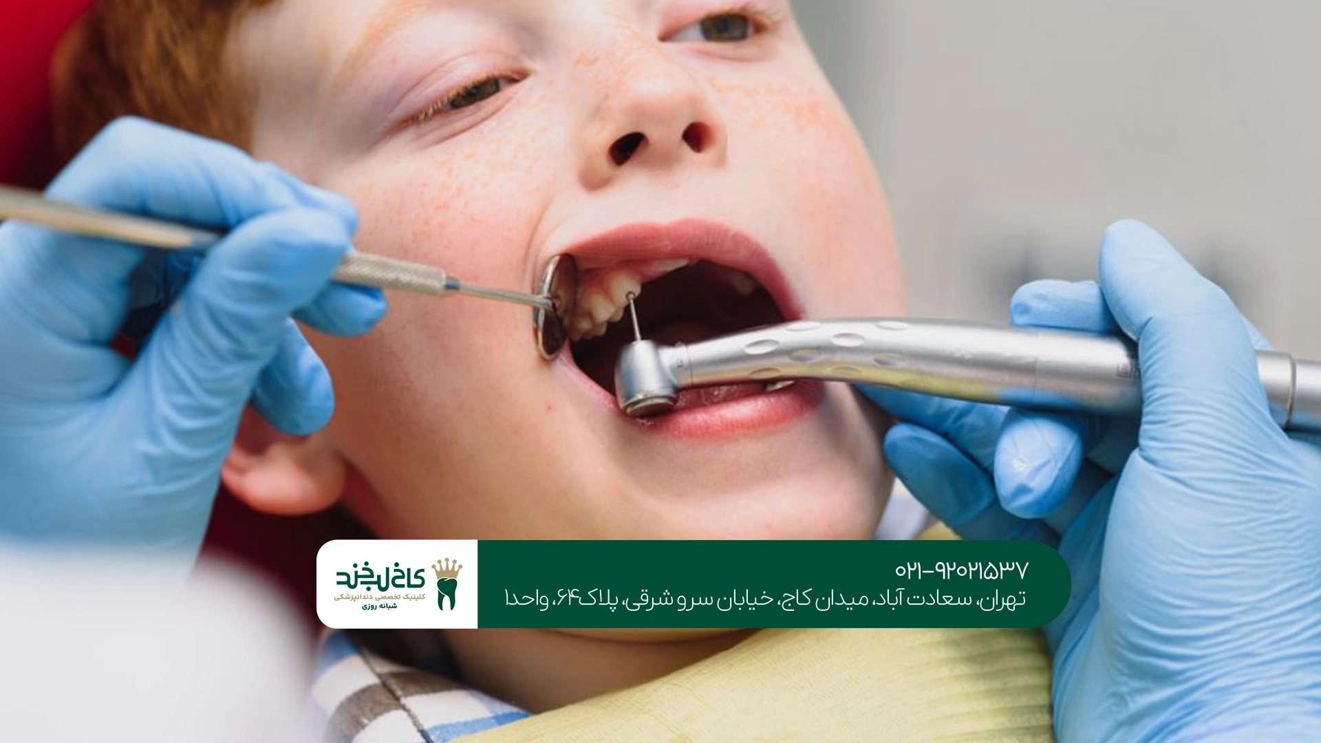 چرا دندانهای شیری در سلامت کودک اهمیت دارند؟