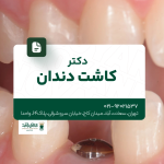 دکتر کاشت دندان