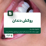 روکش دندان