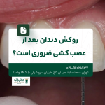 روکش دندان بعد از عصب کشی ضروری است؟