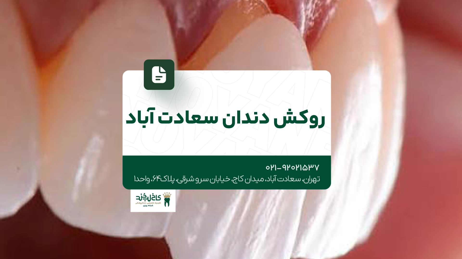 روکش دندان سعادت آباد روکش دندان سعادت آباد