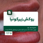 روکش زیرکونیا