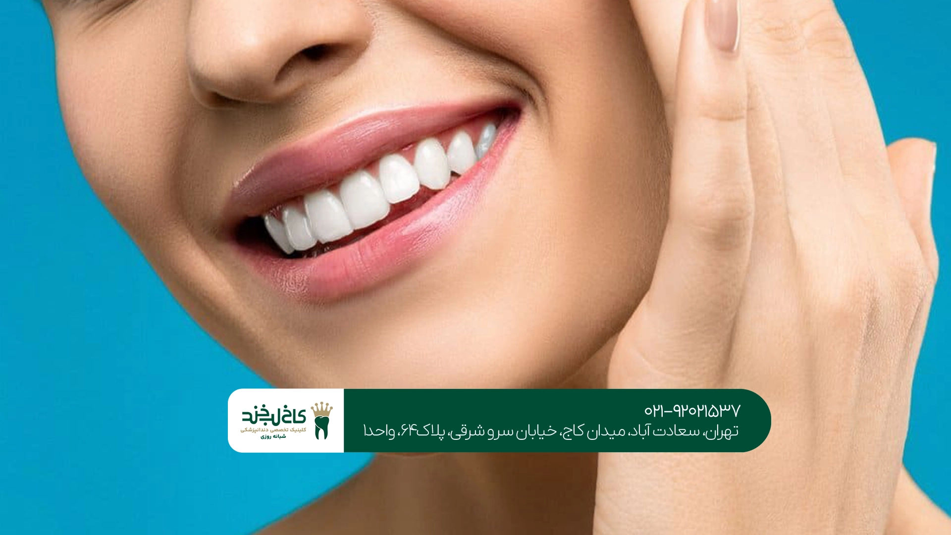 بهترین کلینیک سفید کردن دندان بهترین کلینیک سفید کردن دندان