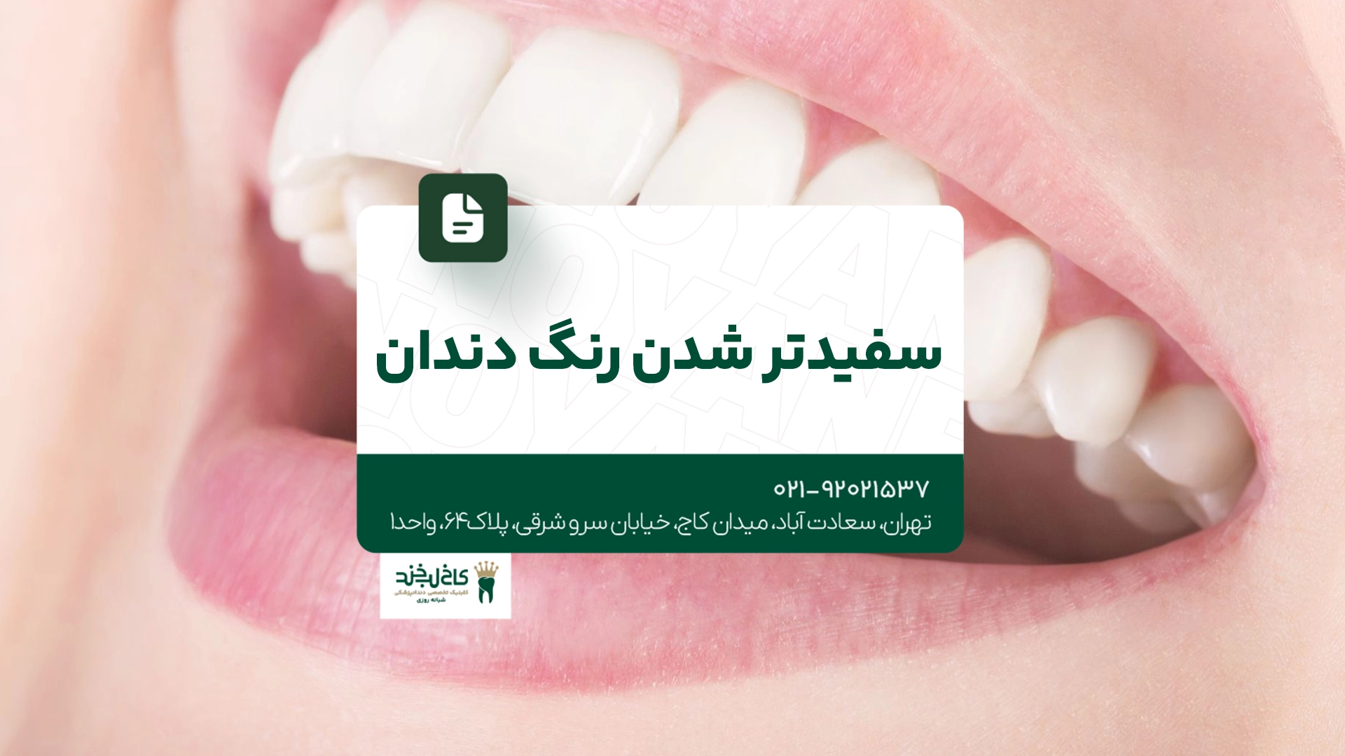 سفیدتر شدن رنگ دندان سفیدتر شدن رنگ دندان
