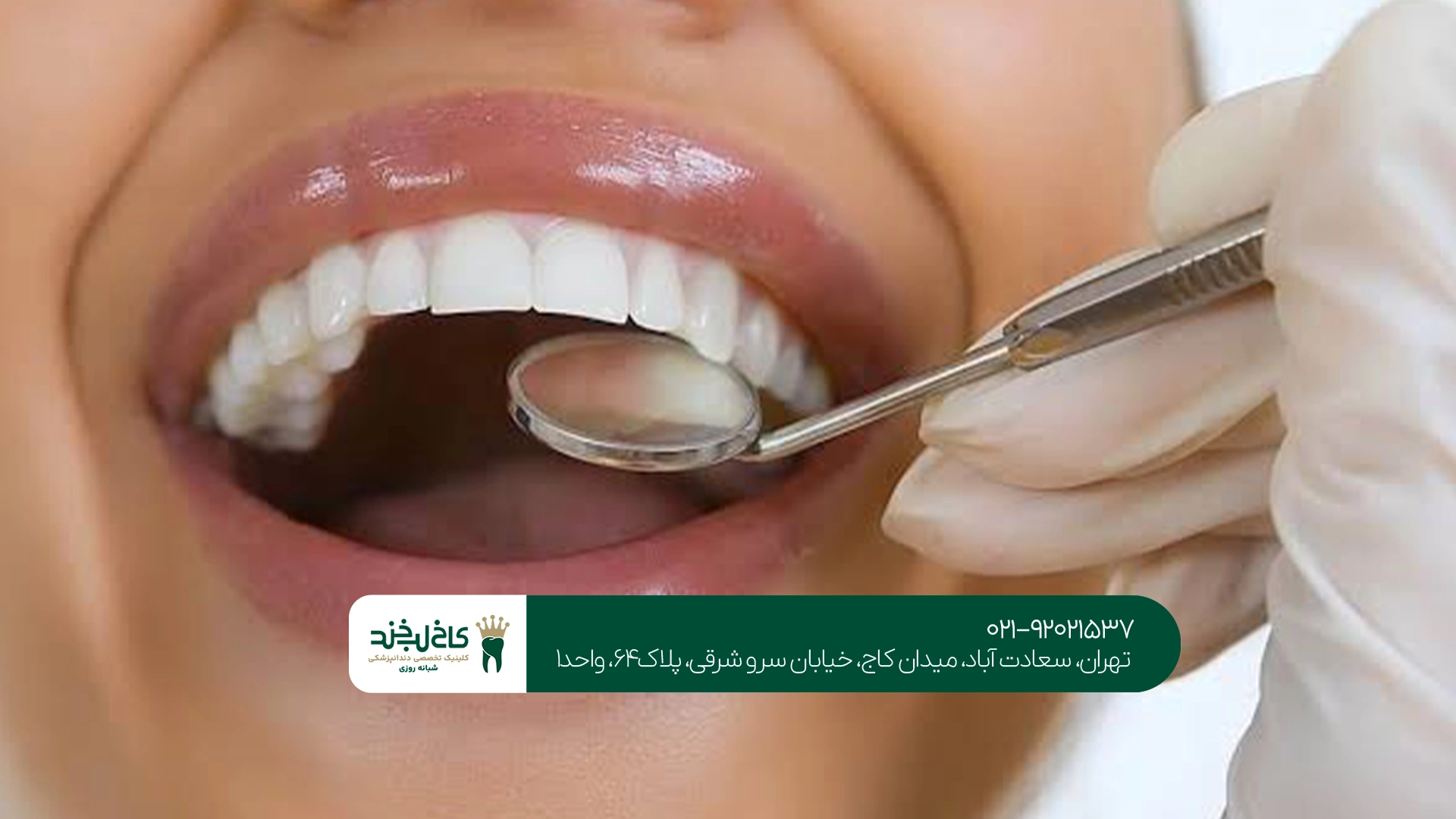 اهمیت اولین معاینه دندانپزشکی کودک