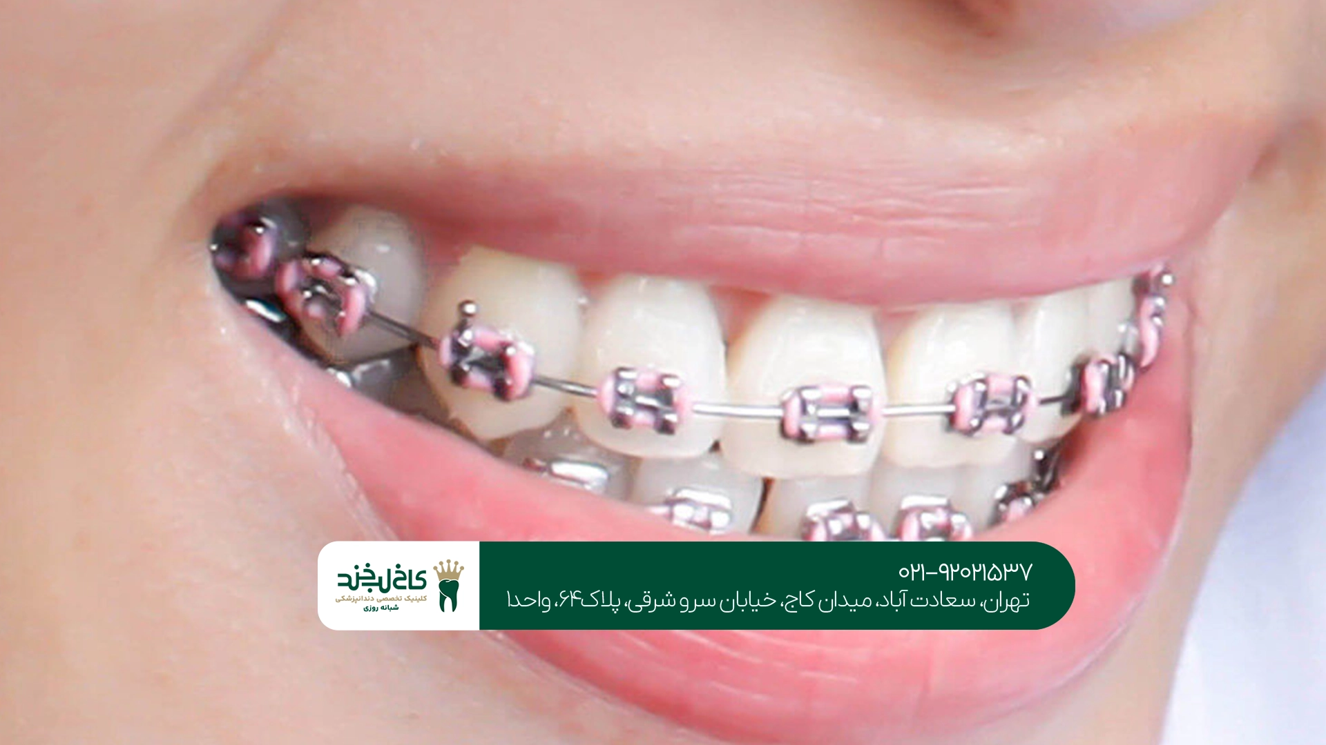 کلینیک تخصصی ارتودنسی کلینیک تخصصی ارتودنسی